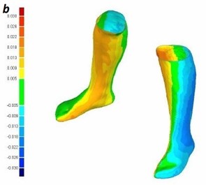 Colored difference in the geometry of the stocking class 1 between the initial position and 4 hours after the initial position