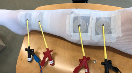 Bioimpedance measurement with four electrodes.